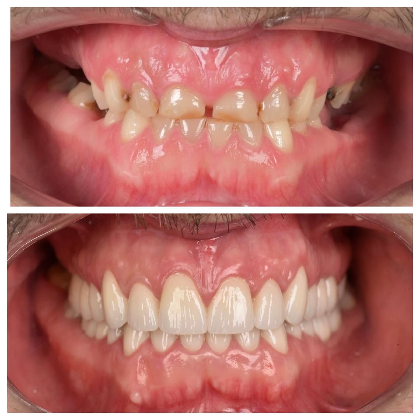 DENTAL CENTAR MARKOVIĆ Sarajevo