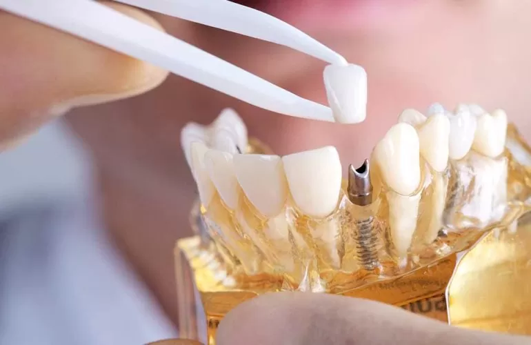 DENTAL CENTAR MARKOVIĆ Sarajevo