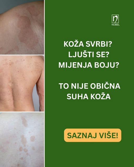 NOBEL BiH d.o.o. Sarajevo