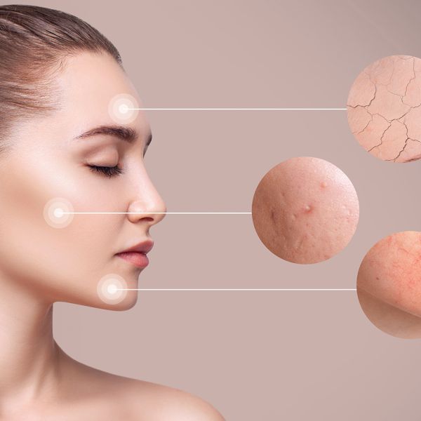 ULTRA BEAUTY CENTAR