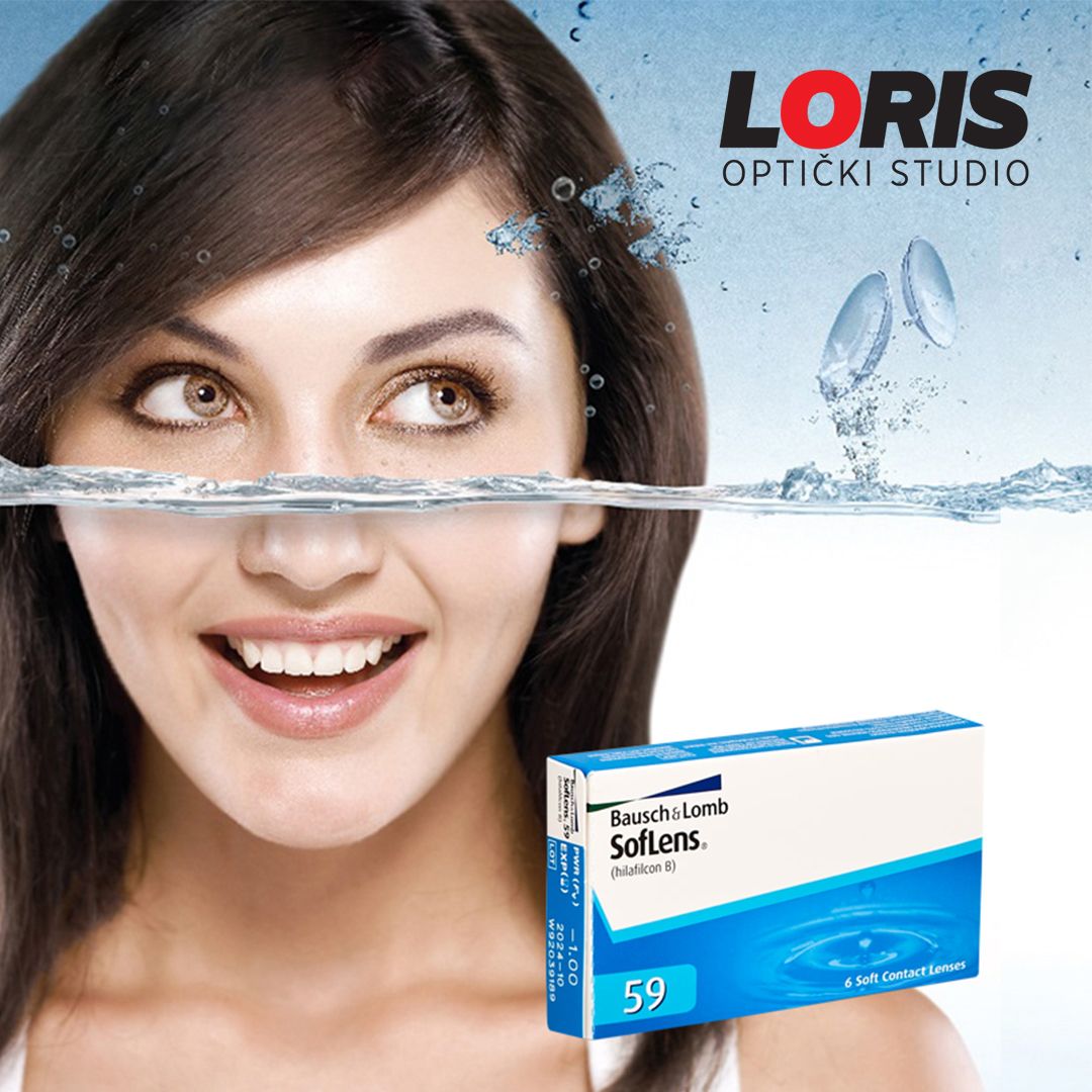 Optika Loris